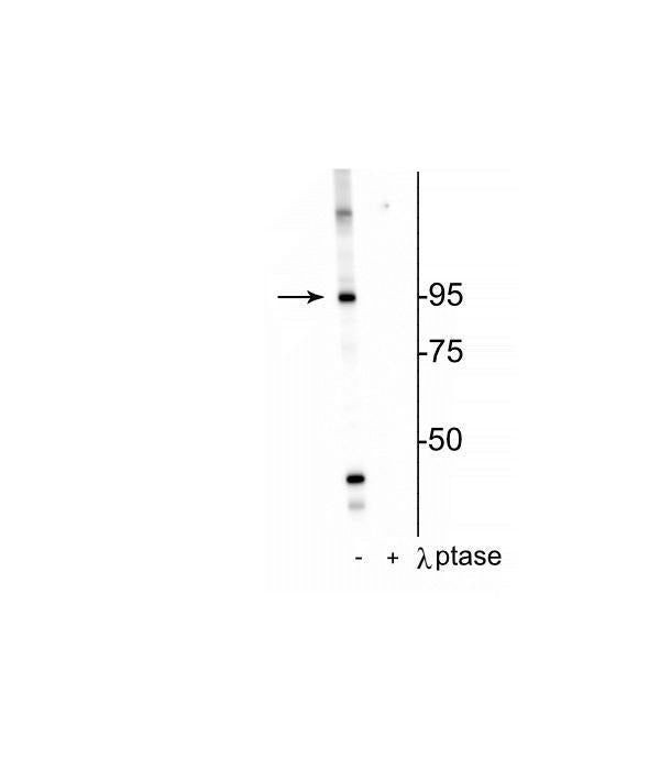 Phospho-INSR (Thr1160) Antibody in Western Blot (WB)