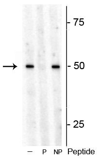Phospho-p70 S6 Kinase (Thr449) Antibody in Western Blot (WB)