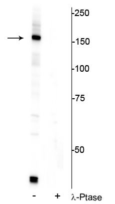 Phospho-FANCI (Ser556) Antibody in Western Blot (WB)