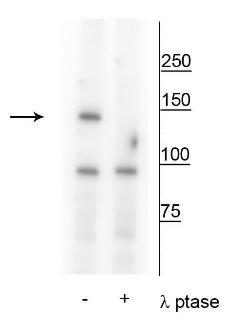Phospho-FANCI (Ser559) Antibody in Western Blot (WB)