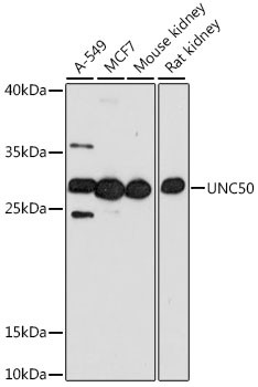 UNC50 Antibody in Western Blot (WB)
