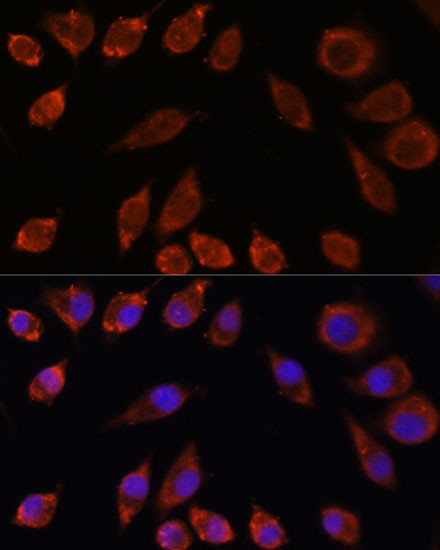HPS4 Antibody in Immunocytochemistry (ICC/IF)