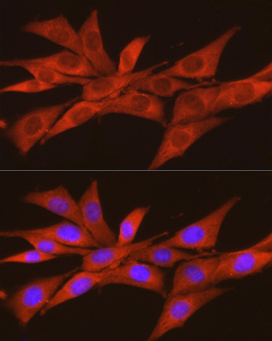 CK2 alpha-2 Antibody in Immunocytochemistry (ICC/IF)
