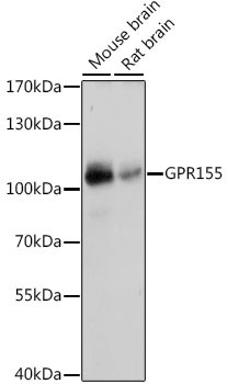 GPR155 Antibody in Western Blot (WB)