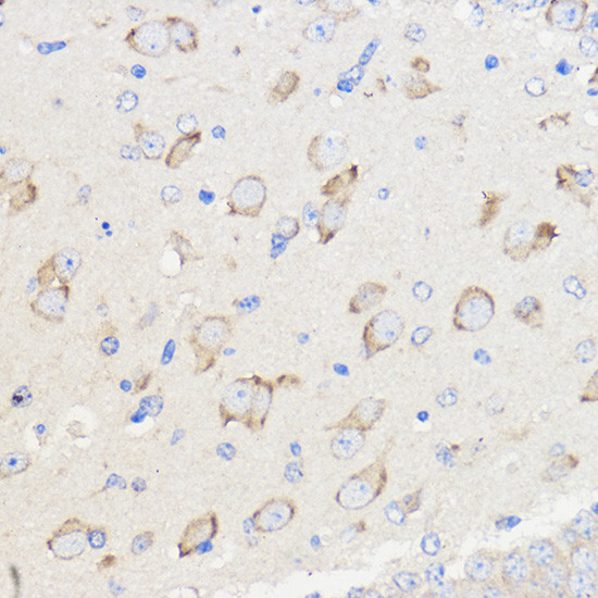 WBSCR27 Antibody in Immunohistochemistry (Paraffin) (IHC (P))