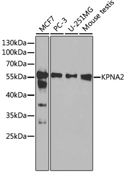 KPNA2 Antibody in Western Blot (WB)