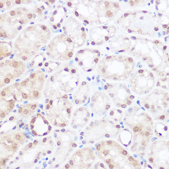BRD2 Antibody in Immunohistochemistry (Paraffin) (IHC (P))
