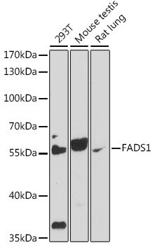 FADS1 Antibody in Western Blot (WB)