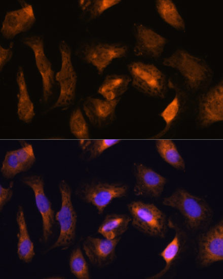 RPS17 Antibody in Immunocytochemistry (ICC/IF)