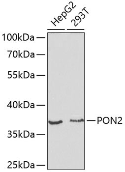 PON2 Antibody in Western Blot (WB)