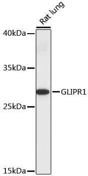 GLIPR1 Antibody in Western Blot (WB)