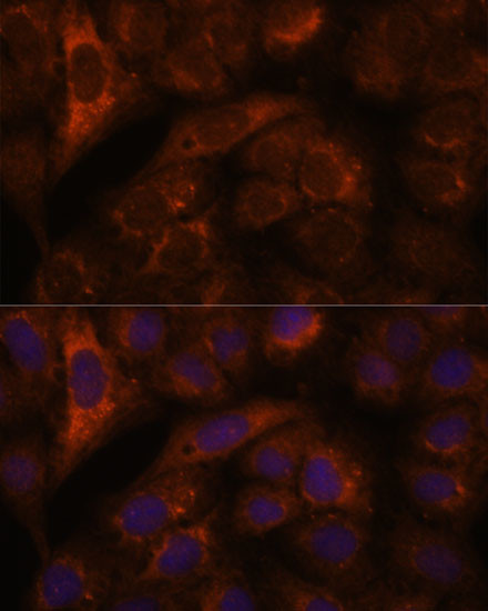 HEBP2 Antibody in Immunocytochemistry (ICC/IF)