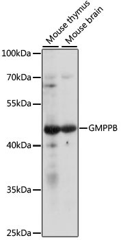 GMPPB Antibody in Western Blot (WB)