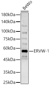 HERV Antibody in Western Blot (WB)