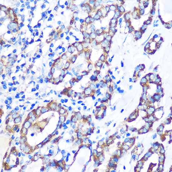 MST4 Antibody in Immunohistochemistry (Paraffin) (IHC (P))