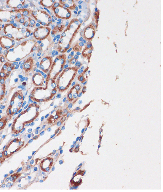 CHDH Antibody in Immunohistochemistry (Paraffin) (IHC (P))
