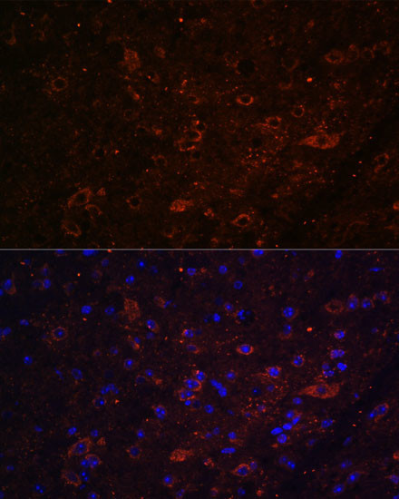 FSTL5 Antibody in Immunohistochemistry (Paraffin) (IHC (P))