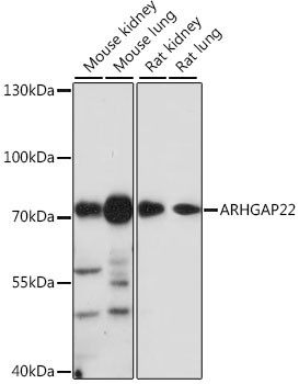 ARHGAP22 Antibody in Western Blot (WB)