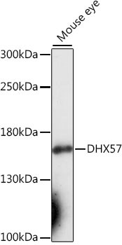 DHX57 Antibody in Western Blot (WB)
