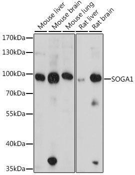SOGA1 Antibody in Western Blot (WB)