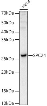 SPC24 Antibody in Western Blot (WB)