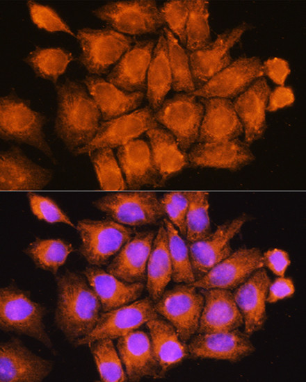 CCDC11 Antibody in Immunocytochemistry (ICC/IF)