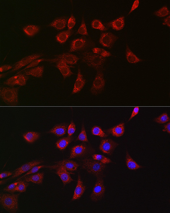 DNM1L Antibody in Immunocytochemistry (ICC/IF)