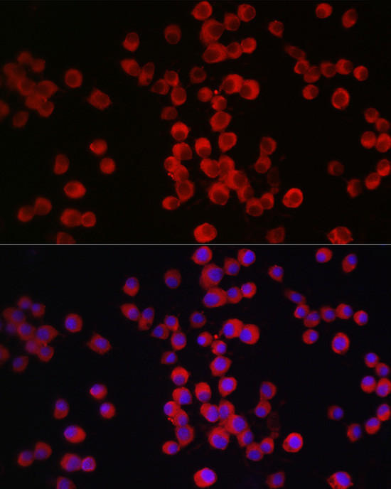 Neuropilin-1 Antibody in Immunocytochemistry (ICC/IF)