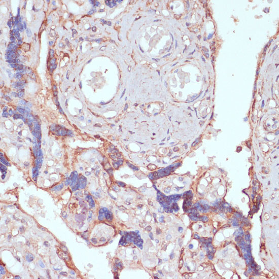 ARL4D Antibody in Immunohistochemistry (Paraffin) (IHC (P))