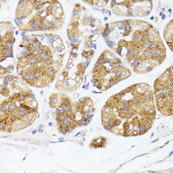 BMPR2 Antibody in Immunohistochemistry (Paraffin) (IHC (P))