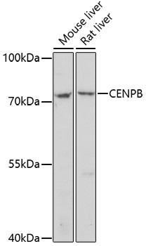CENPB Antibody in Western Blot (WB)