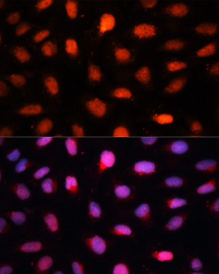 CtBP2 Antibody in Immunocytochemistry (ICC/IF)