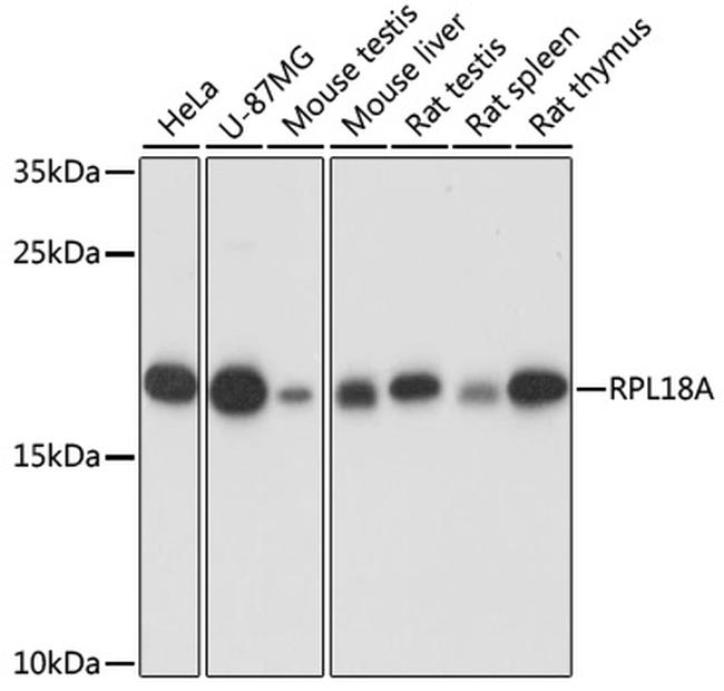 RPL18A Antibody in Western Blot (WB)