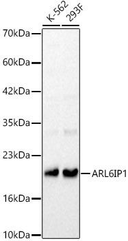 ARMER Antibody in Western Blot (WB)