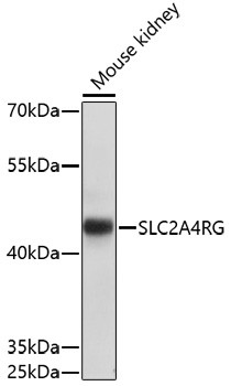 SLC2A4RG Antibody in Western Blot (WB)