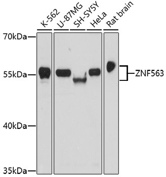 ZNF563 Antibody in Western Blot (WB)