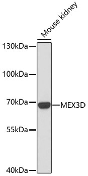 RKHD1 Antibody in Western Blot (WB)