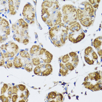HDAC6 Antibody in Immunohistochemistry (Paraffin) (IHC (P))