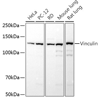 Vinculin Antibody in Western Blot (WB)
