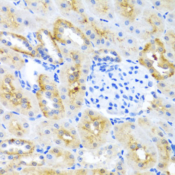 MOK Antibody in Immunohistochemistry (Paraffin) (IHC (P))