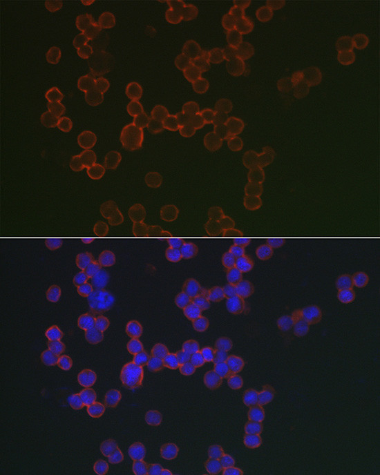 CD20 Antibody in Immunocytochemistry (ICC/IF)