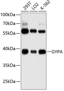 CD235a Antibody in Western Blot (WB)