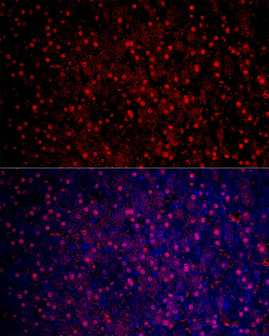 Arginase 1 Antibody in Immunocytochemistry (ICC/IF)