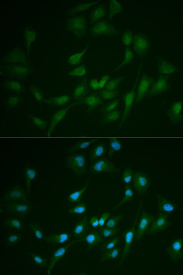 DNA Ligase I Antibody in Immunocytochemistry (ICC/IF)