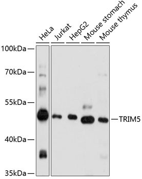 TRIM5 alpha/beta/gamma/delta/epsilon/iota Antibody in Western Blot (WB)