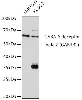GABRB2 Antibody in Western Blot (WB)