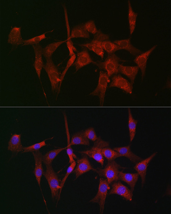 Fascin Antibody in Immunocytochemistry (ICC/IF)