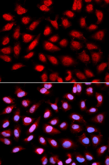 PPP2R4 Antibody in Immunocytochemistry (ICC/IF)