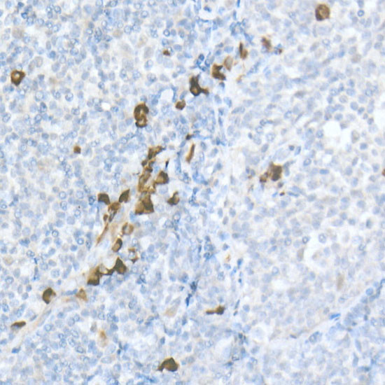 MDC Antibody in Immunohistochemistry (Paraffin) (IHC (P))
