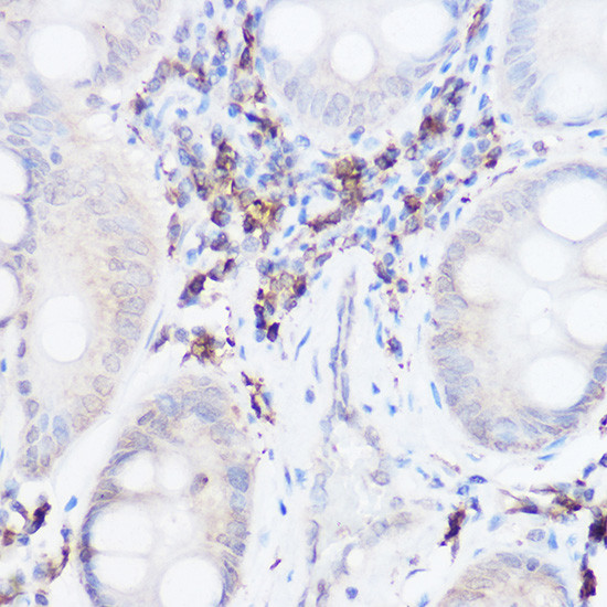 Thromboxane synthase Antibody in Immunohistochemistry (Paraffin) (IHC (P))